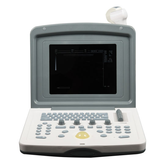 (MS-P800) Escáner de ultrasonido Doppler portátil de precio barato para computadora portátil